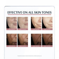Eucerin Anti-Pigment Spot Corrector 5ml